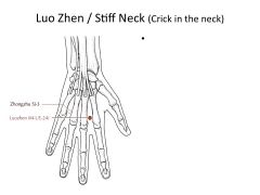 Luo Zhen Xue - Neck Pain Relief Point
